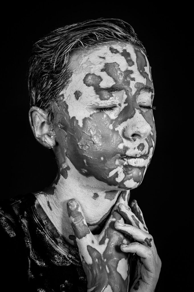 ニキビ跡の色素沈着を改善するための男性向けケア方法は？