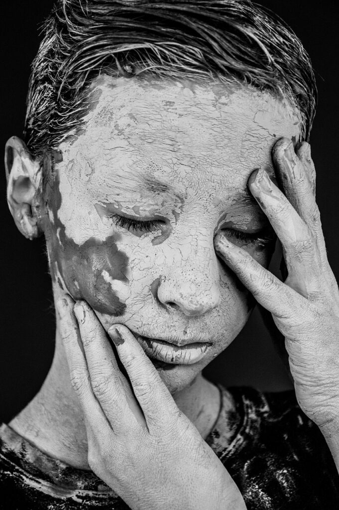 男性のニキビ跡の色素沈着を改善する方法は？